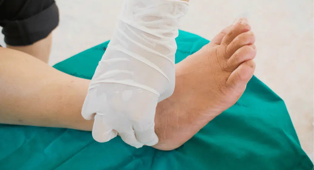 Charcot Foot Reconstruction & Advanced Wound Care