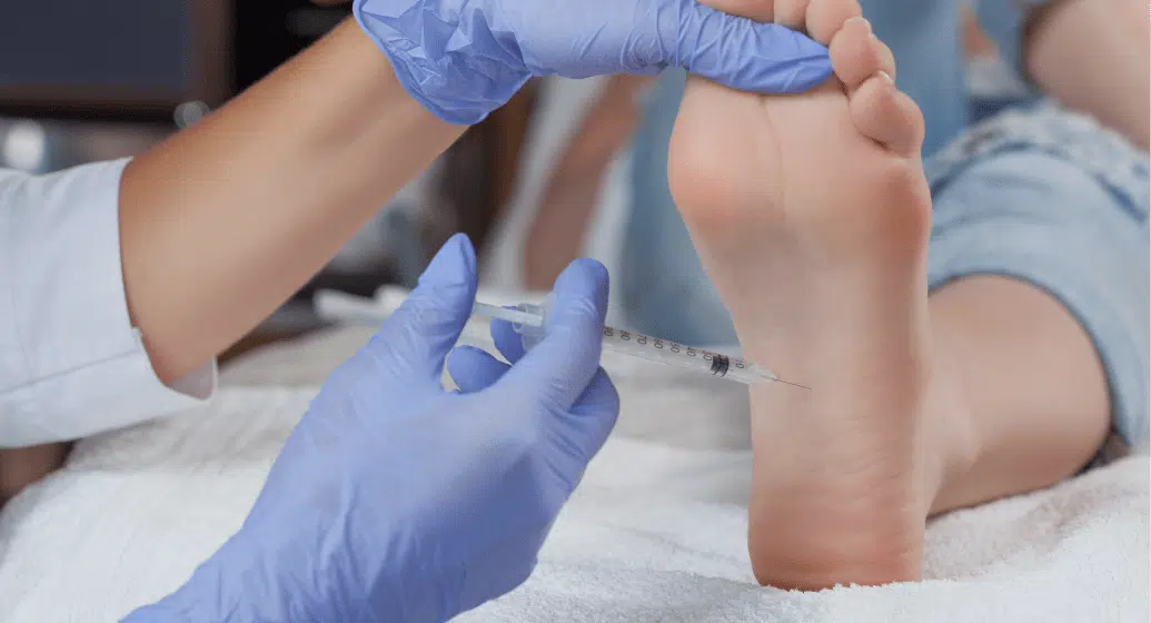 Corticosteroid Injections