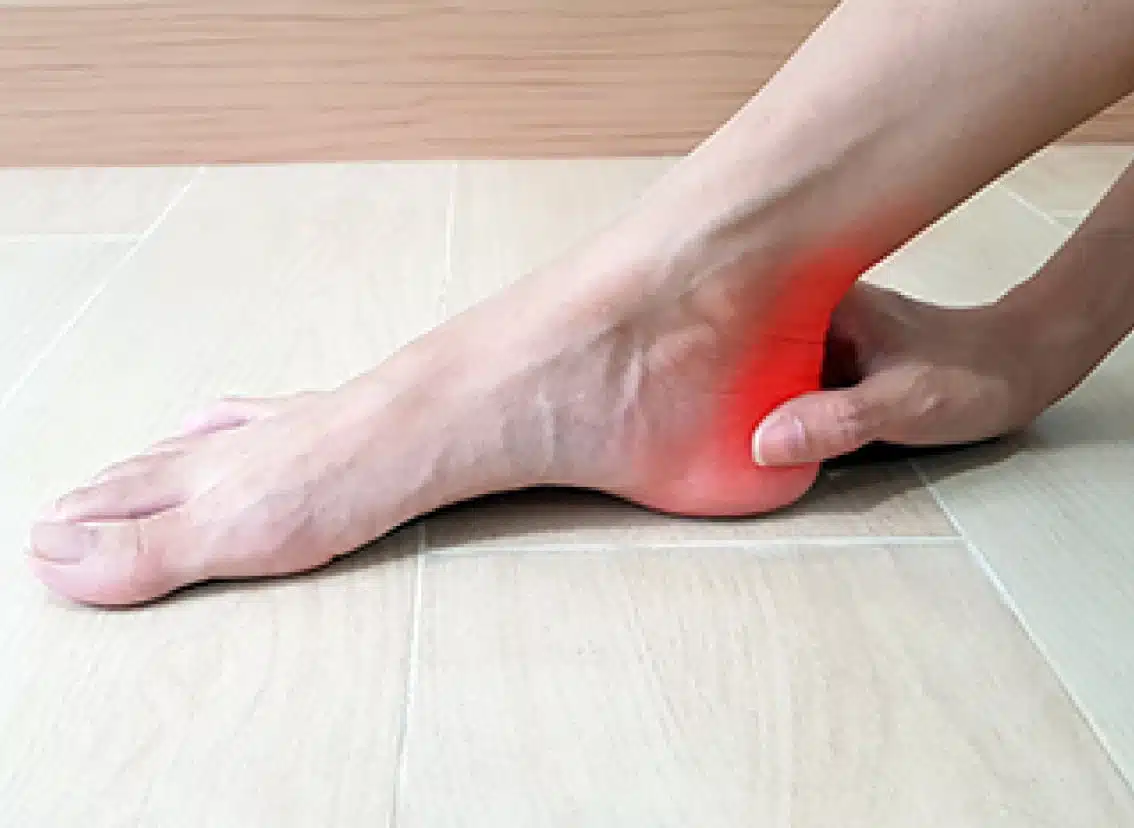 Managing Achilles Tendinosis