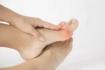 Early Signs of Bunions
