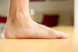 Flat Feet