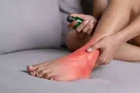 How to Care for Your Arthritic Foot