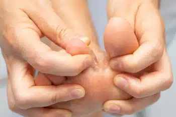 Types and Symptoms of Athlete’s Foot